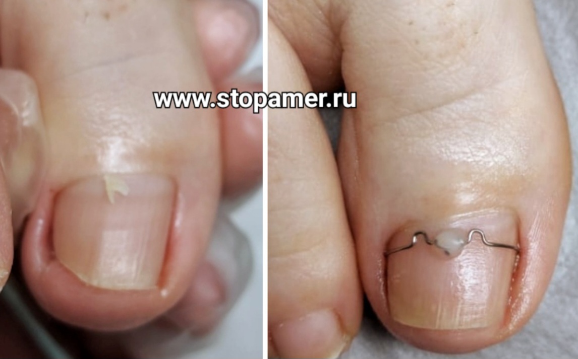 ЗТО Алена