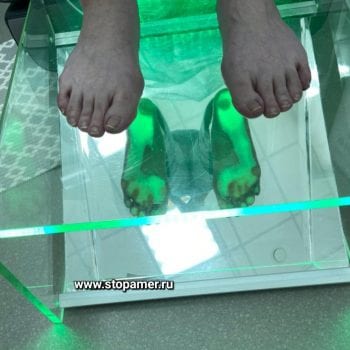 3 фото диагностика плоскостопия нарушений свода стопы